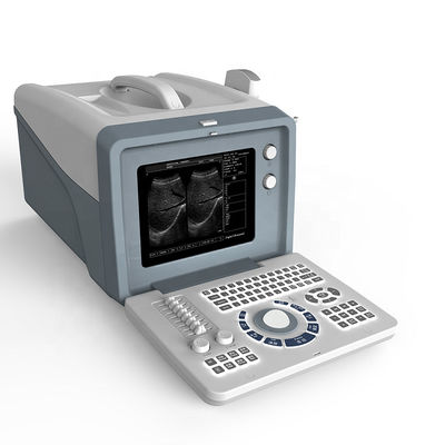 qualidade  Ultrasound laptop diagnostic ultrasound machine /black and white ultrasound scanner with 15 inch LCD screen fábrica