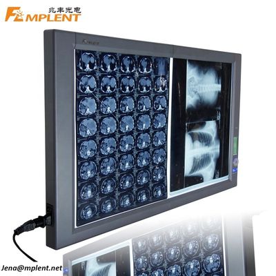 qualidade  Super Bright Digital Dual General Film Medical Negatoscope LED X Ray Viewer fábrica